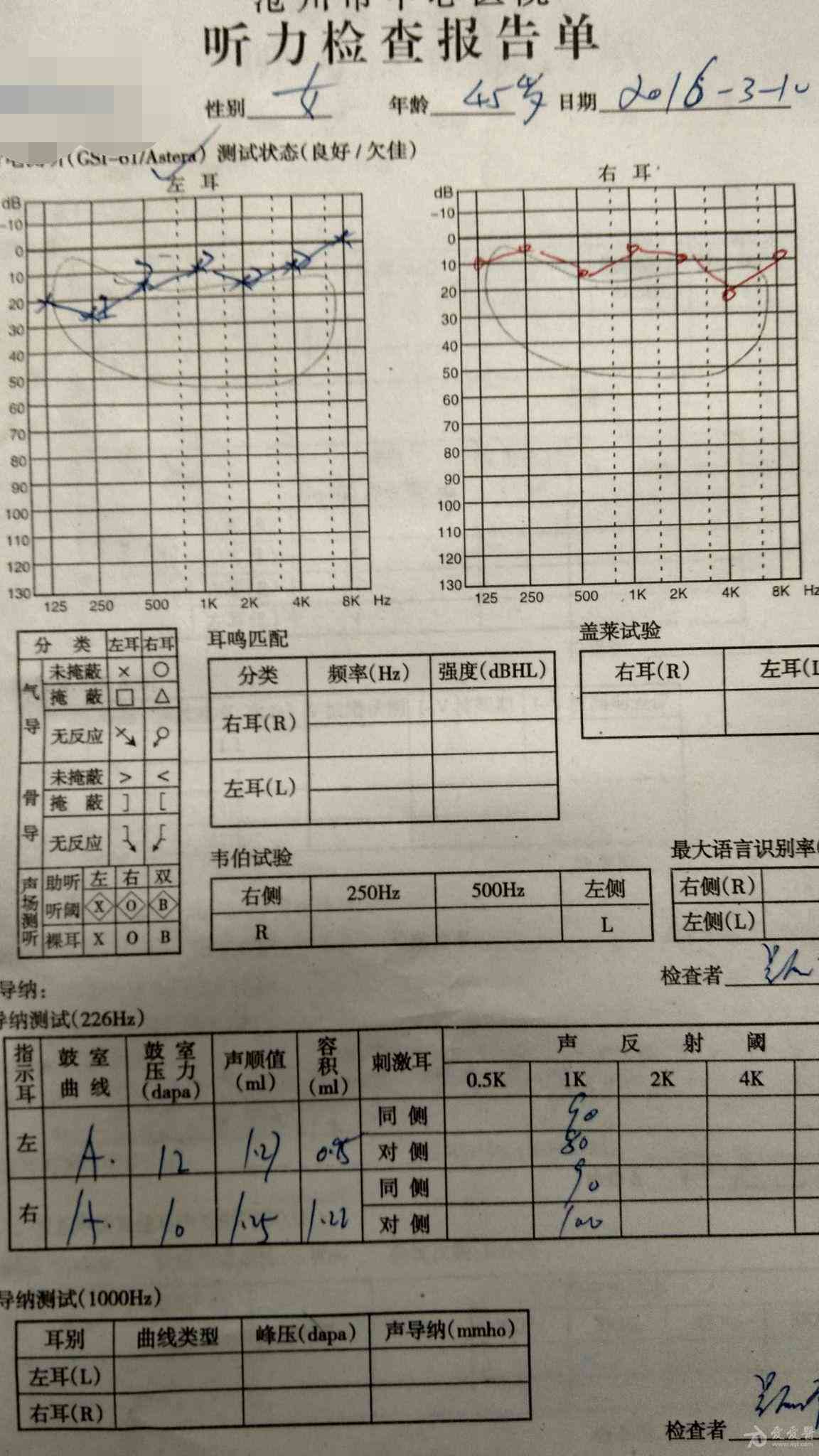 听力检测报告术语解读：全面解析各项字母代表的含义及意义