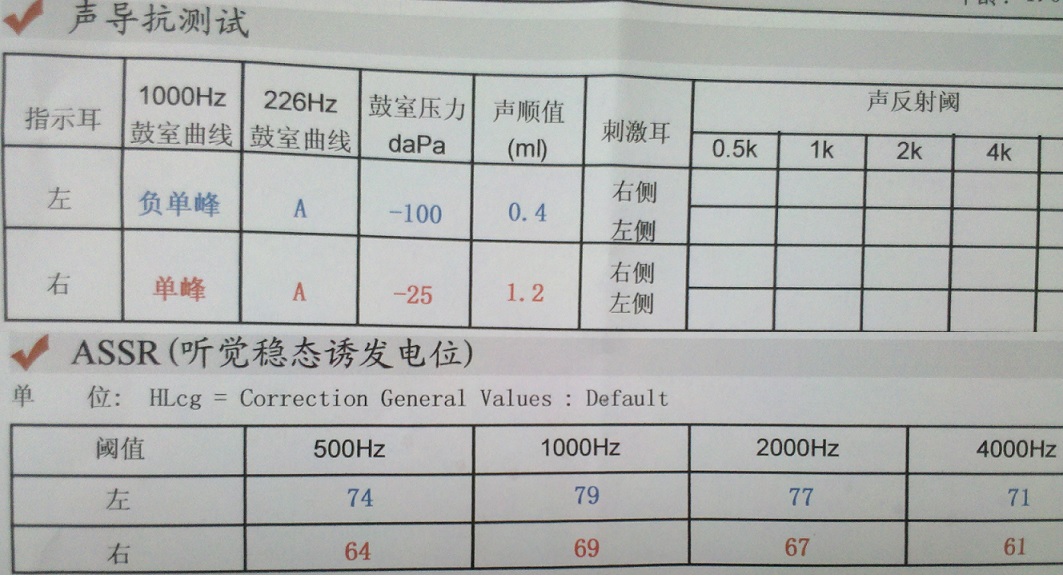 听力检测报告术语解读：全面解析各项字母代表的含义及意义