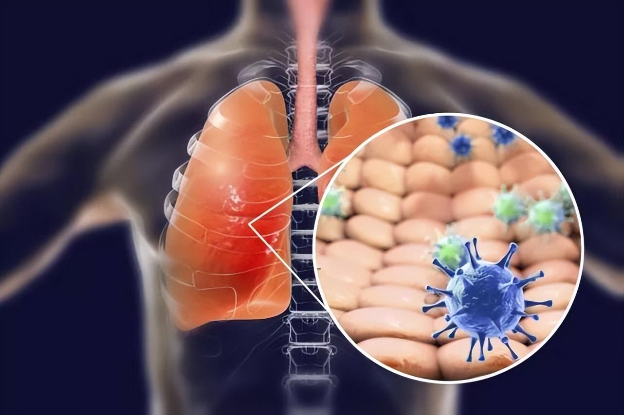 尘肺检测时间、方法及早期症状：全面解析尘肺病的发现与诊断