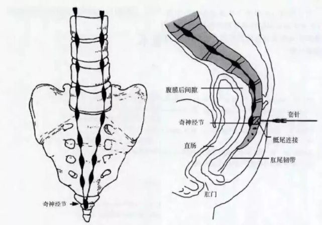 尾椎变形对顺产的影响及分娩方式选择指南