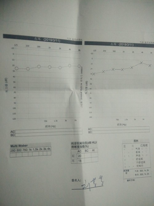 电测听报告单上ai值是什么