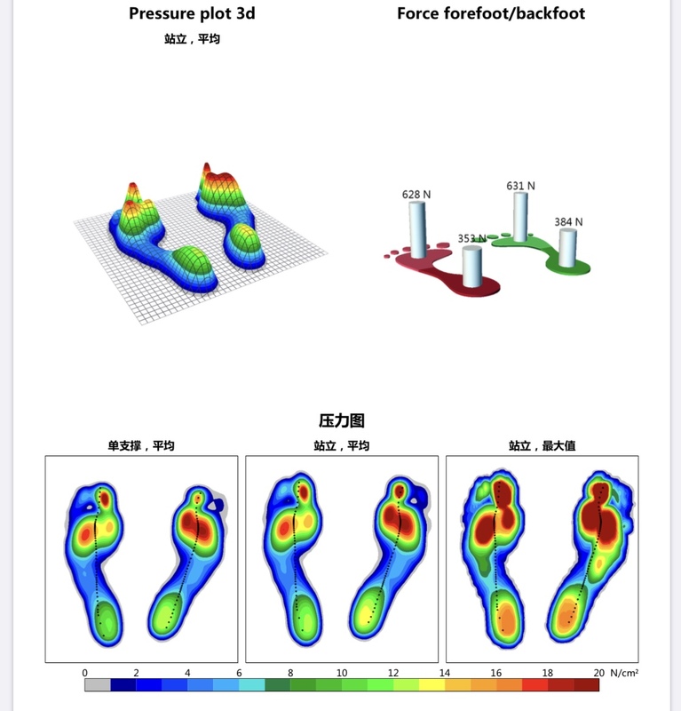 '智能AI驱动的足底健分析与评估报告'