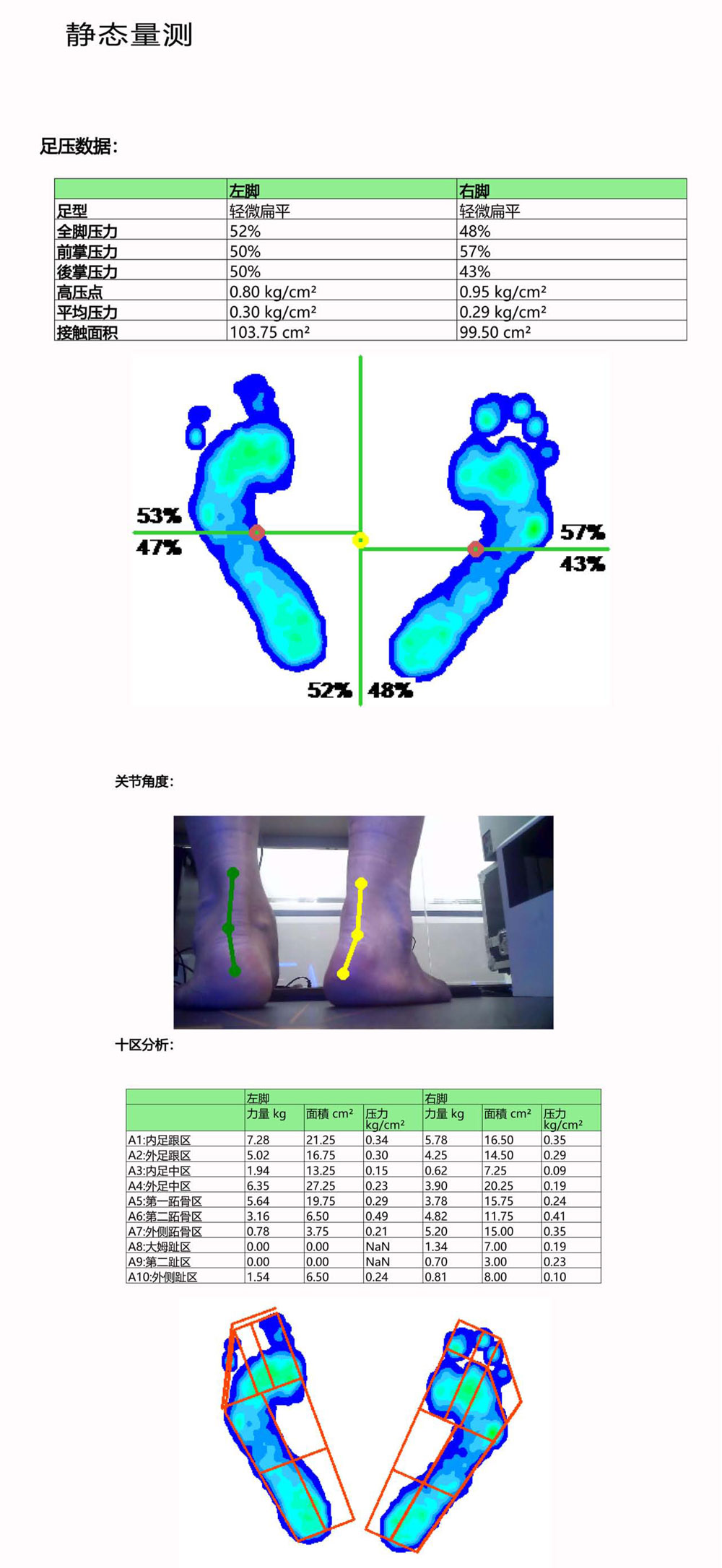 '智能AI驱动的足底健分析与评估报告'