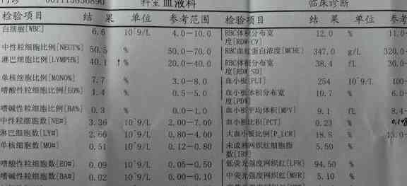 AI智能解读血常规报告，全面解析各项指标及临床意义