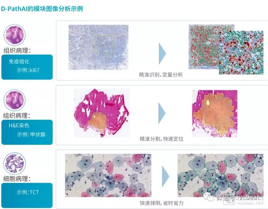 '滇南医疗AI辅助病理报告在线查询平台'