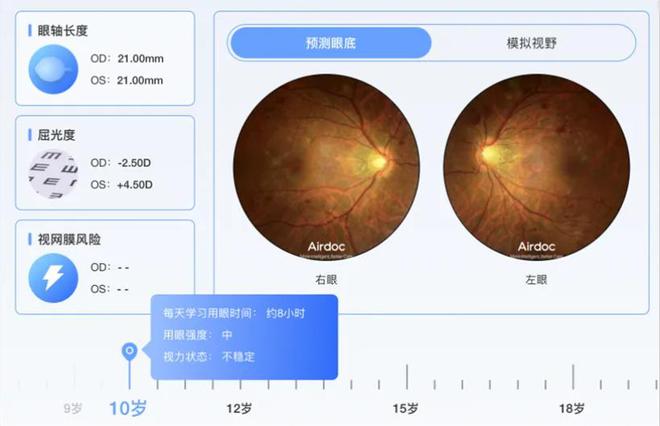 '智能宝岛AI眼底相机检测报告：精准捕捉眼底病变数据'