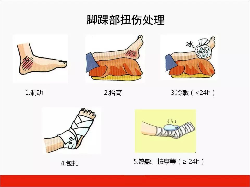 肌肉拉伤急救与复指南：如何有效处理干活时肌肉损伤问题