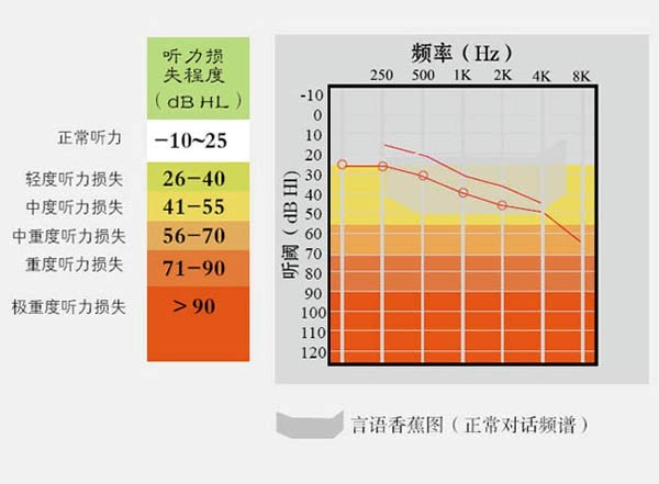 纯音听力检测标准正常参考值解析