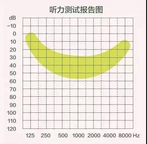 听力健评估：纯音听阈检测综合报告