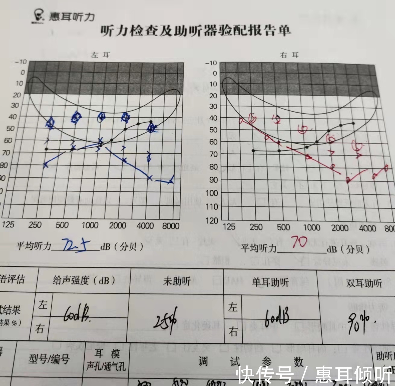 听力健评估：纯音听阈检测综合报告