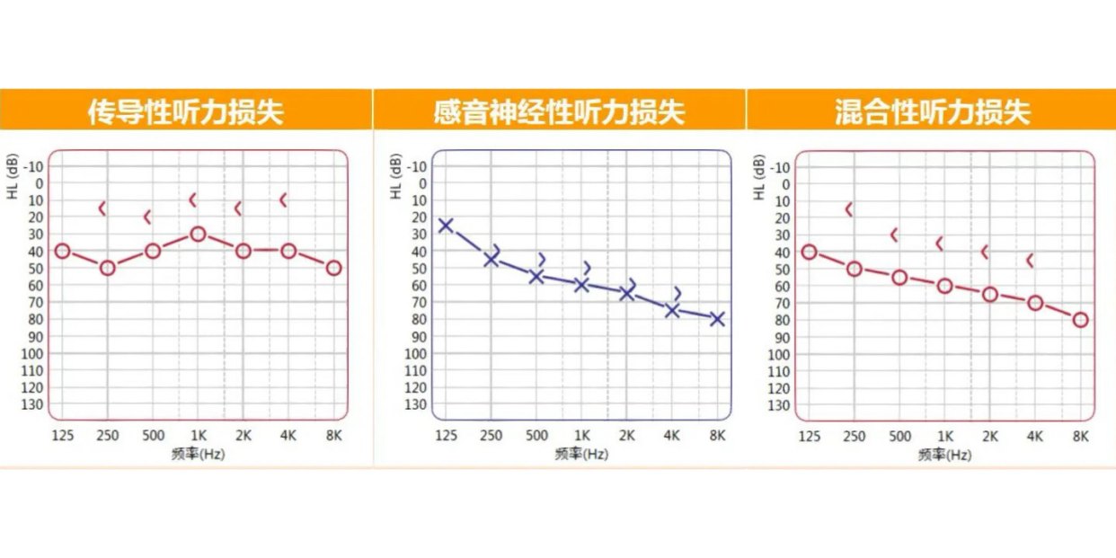 听力健评估：纯音听阈检测综合报告