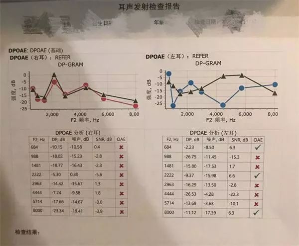 听力健评估：纯音听阈检测综合报告