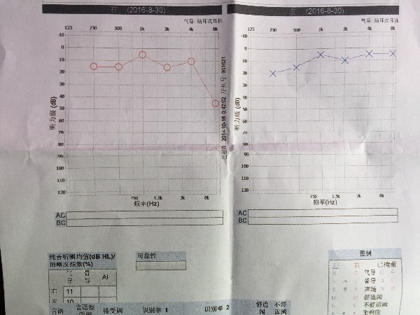 听力健评估：纯音听阈检测综合报告