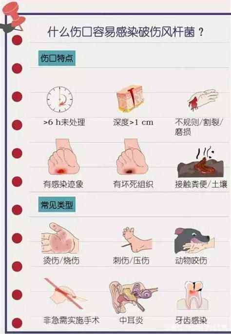 破伤风感染是否属于工伤：工伤认定标准与案例分析