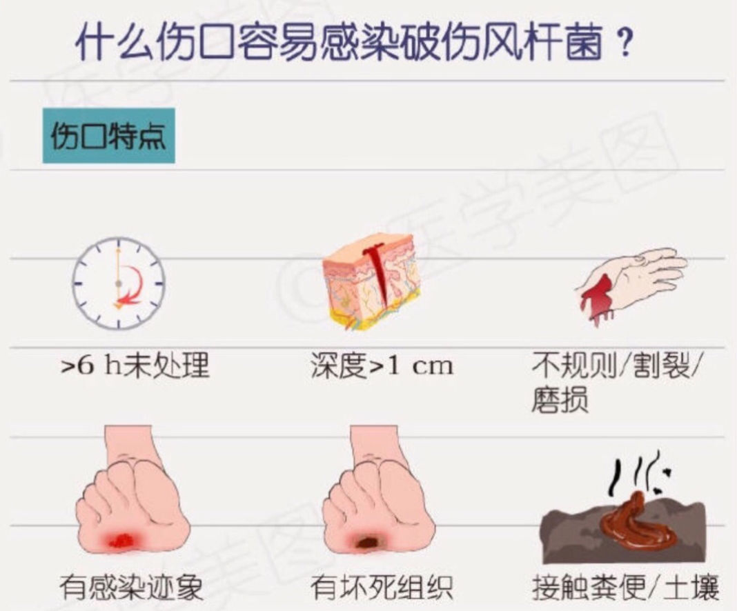 得了破伤风可以认定工伤吗