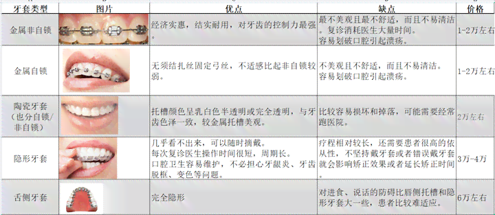 工伤认定新标准：牙齿脱落能否被纳入工伤范畴？