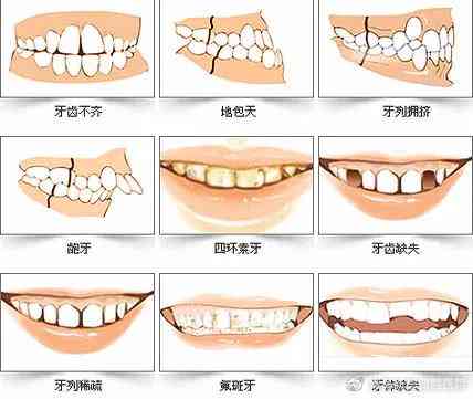 牙齿脱落伤残鉴定标准：脱落数量、影响评估及鉴定流程详解