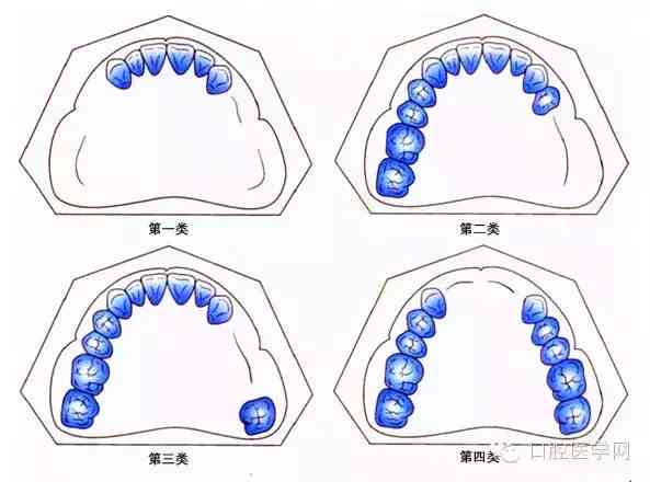 牙齿缺失是否构成伤残：鉴定标准及伤残等级划分