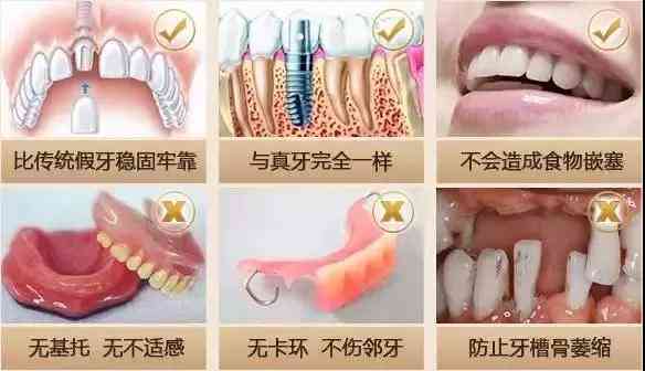 牙齿缺失是否构成伤残：鉴定标准及伤残等级划分