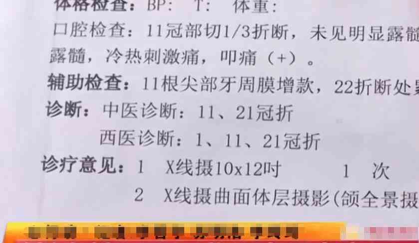 牙齿被撞断了能认定工伤吗怎么赔偿，牙齿摔断工伤认定及赔偿标准详解