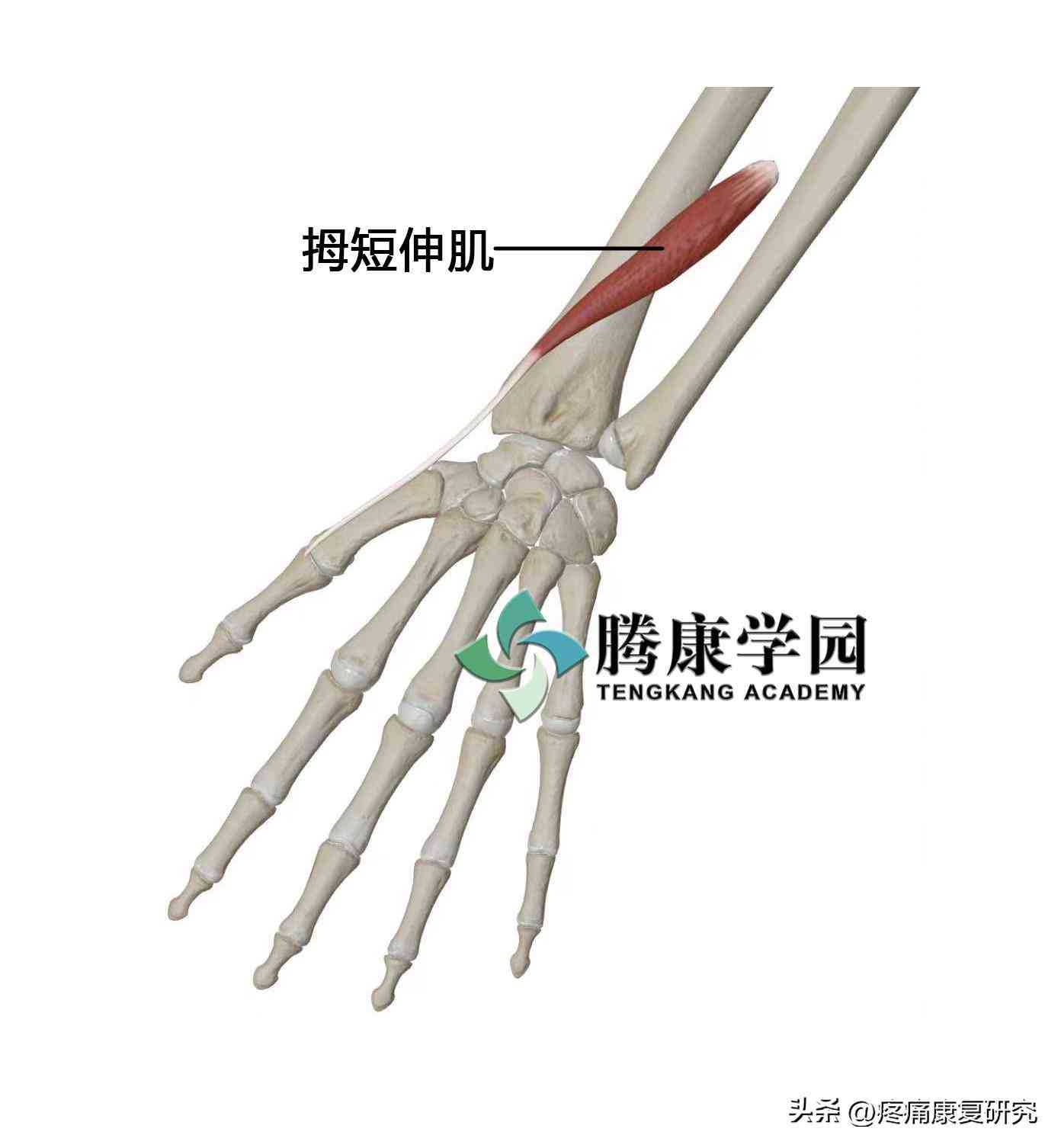 狭窄性腱鞘炎患者如何合理安排日常劳动与活动：预防与应对策略全解析