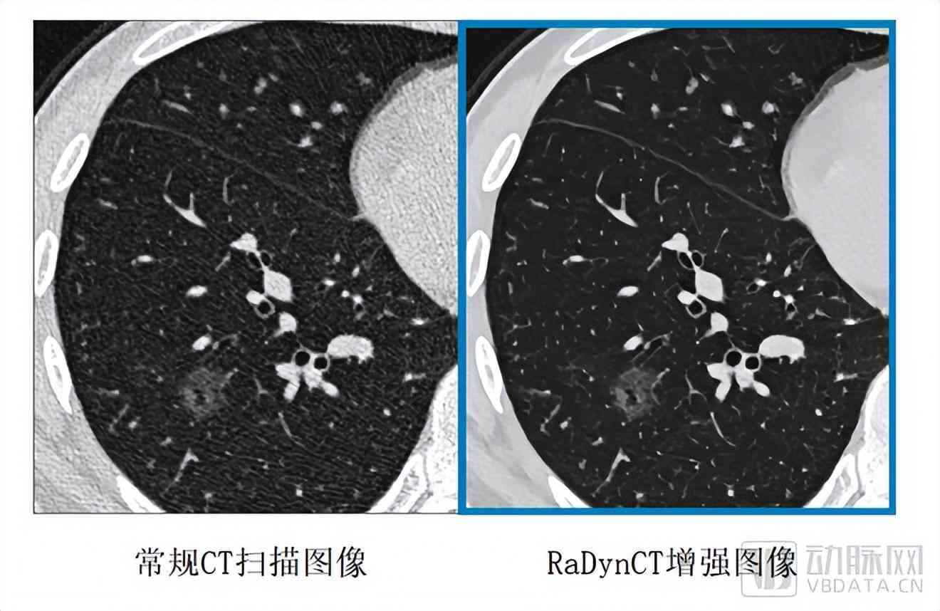 人工智能在医疗影像应用中的实策略与成效分析报告