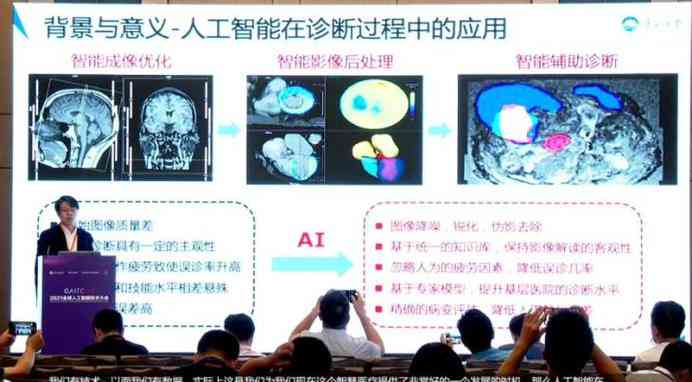 AI赋能医学影像报告