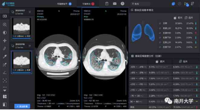 手机ai看医学报告软件：推荐与评测，查看医院检查报告的选择