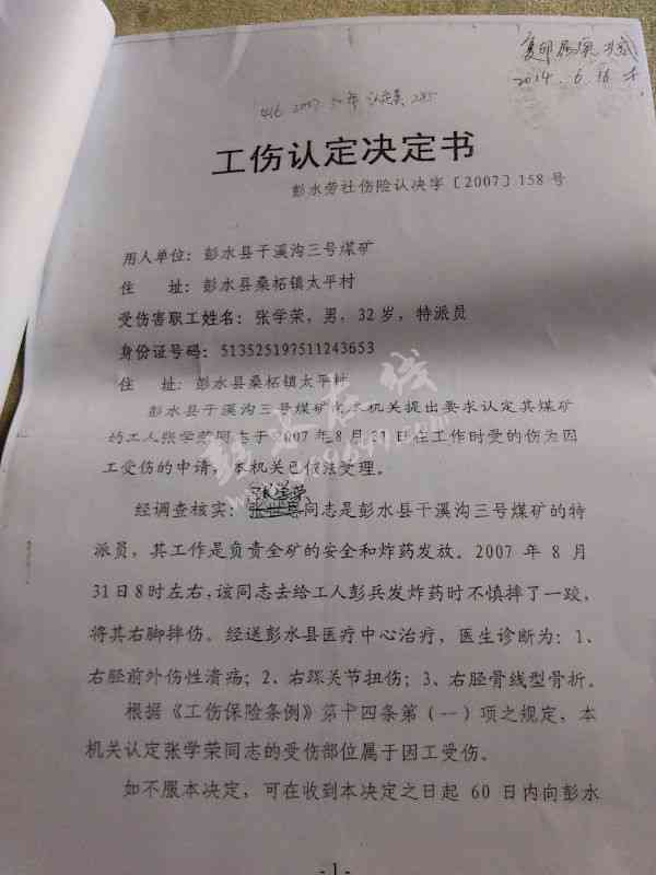 病案造假怎么认定工伤的