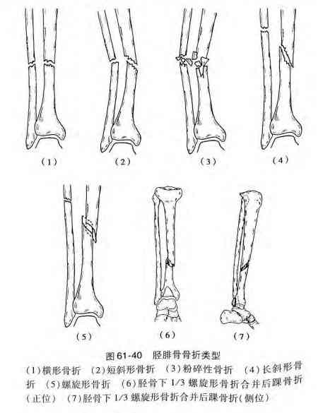 病案造假怎么认定工伤赔偿