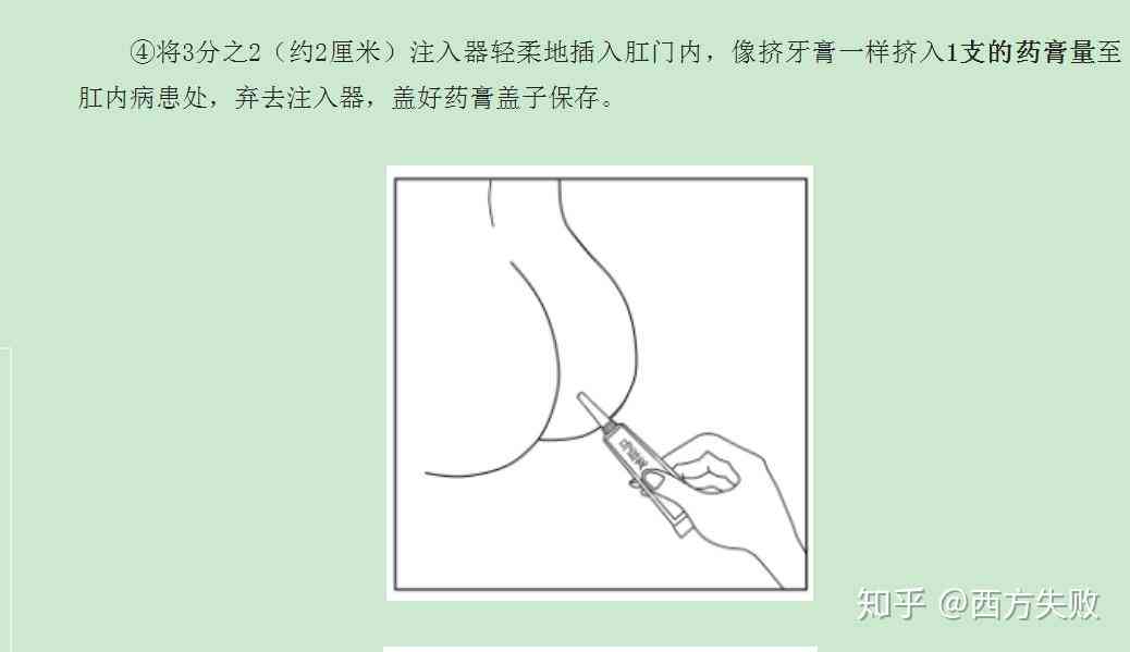 痔疮和肛裂能认定工伤吗