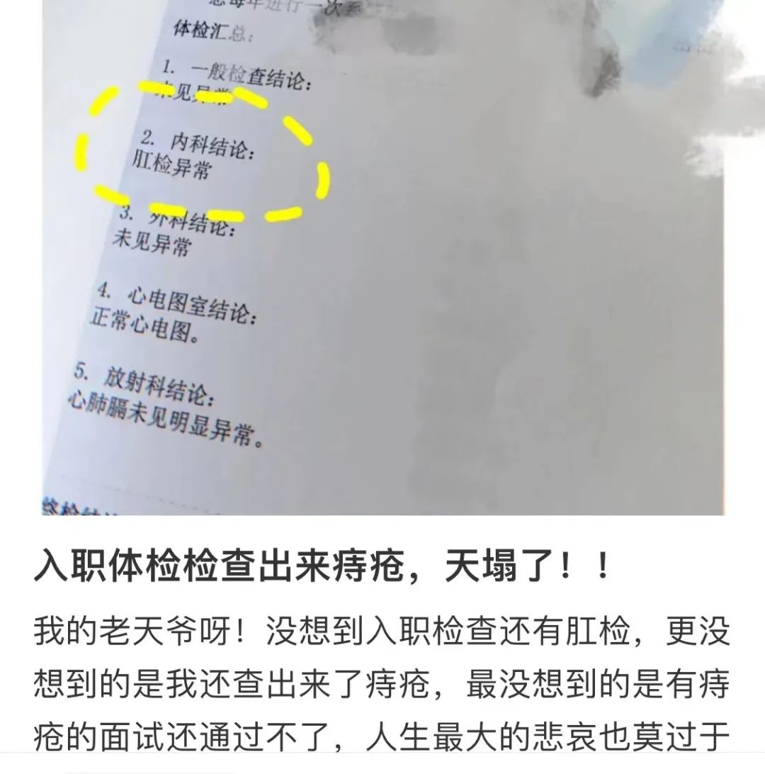 '痔疮能否认定为病假：员工权益与健管理探讨'