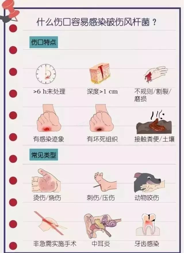 轻微皮外擦伤是否必须接种破伤风疫？