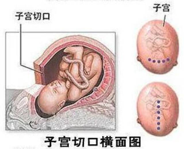 探讨盘状半月板损伤的非手术疗法可能性