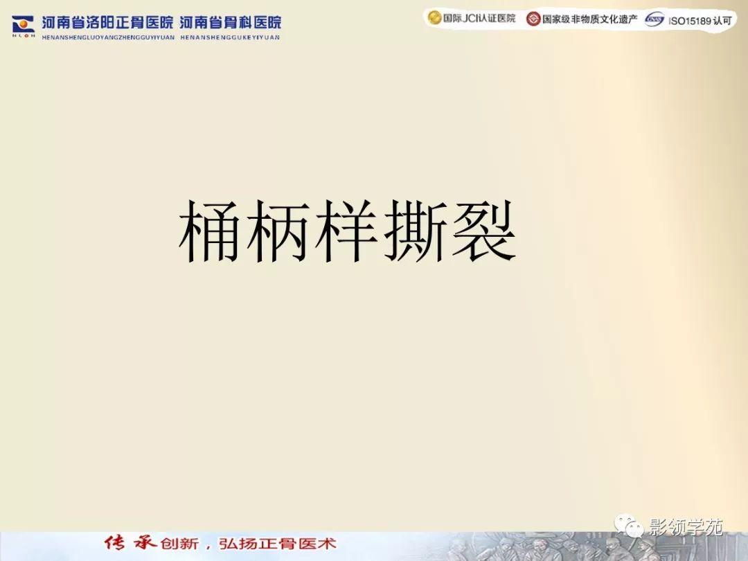 盘状半月板能鉴定伤残吗：损伤算工伤、手术必要性及摘除后评残标准解析