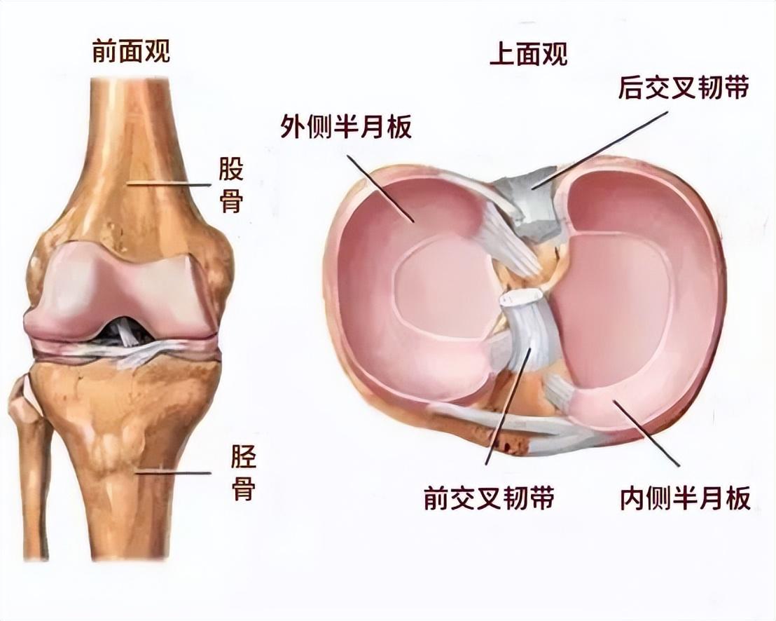 盘状半月板能认定工伤吗