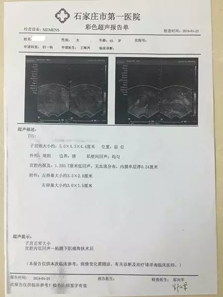 分享宝宝三维彩超照：见证生命的奇迹，感受爱的度