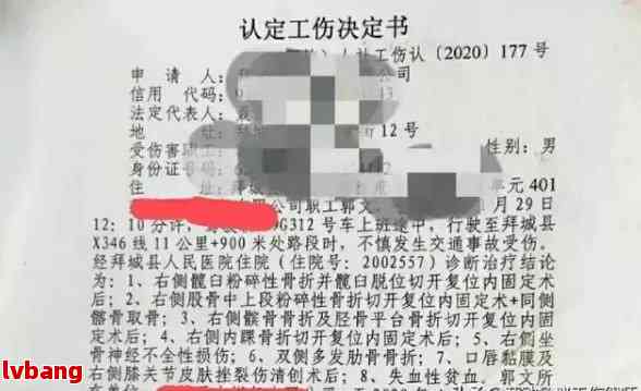 眼部轻伤怎么认定工伤