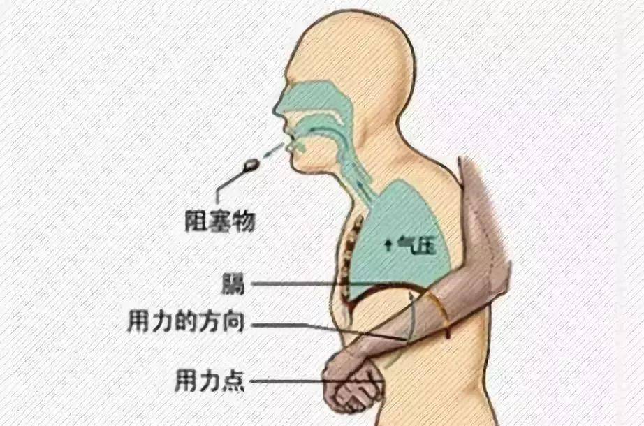 如何快速有效处理碰撞导致的肿胀：全方位消肿技巧与建议