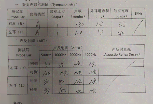 AI辅助听力测试报告中正常阈值范围解析