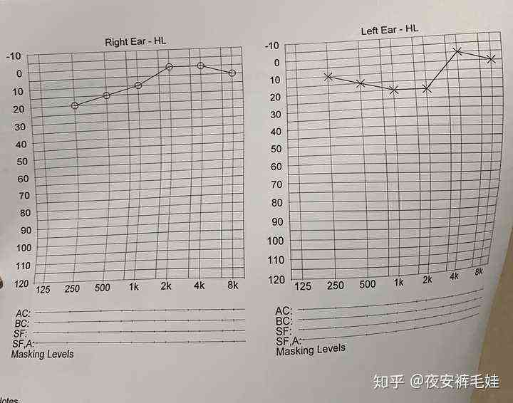 AI辅助听力测试报告中正常阈值范围解析