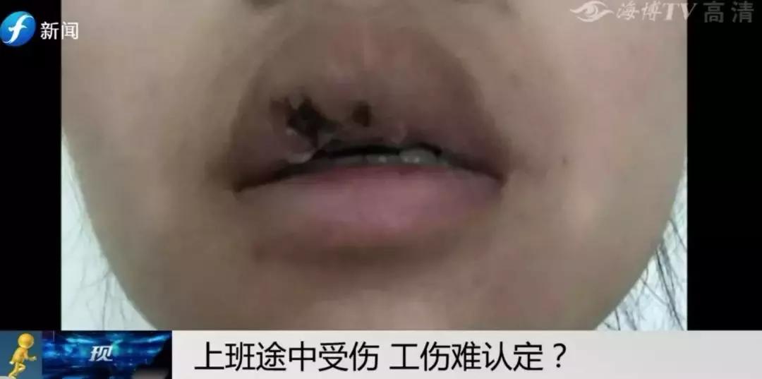 私人企业受伤怎么认定工伤