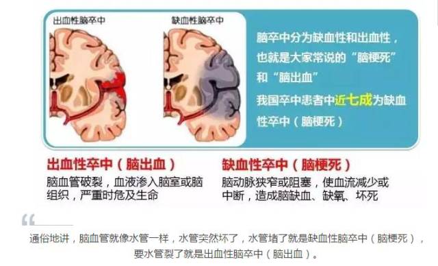 突发脑出血能否被认定为意外伤害险理赔范畴