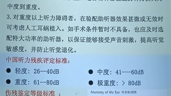 突发性耳聋如何申请残疾评定及评定标准解析