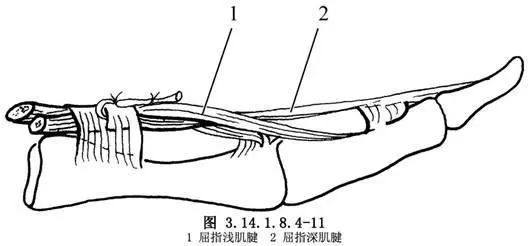 筋撕裂治疗指南：探讨手术与非手术治疗的适用情况及恢复要点