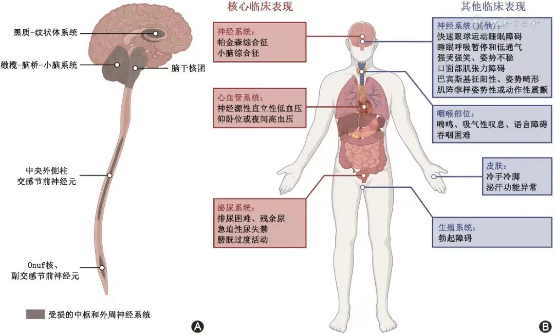 筋膜炎病情严重性评估：能否进行伤残等级鉴定