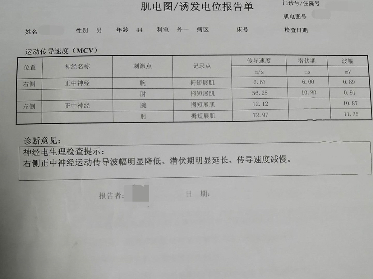 腕管综合征算是工伤吗：如何认定及申报腕管综合征工伤问题