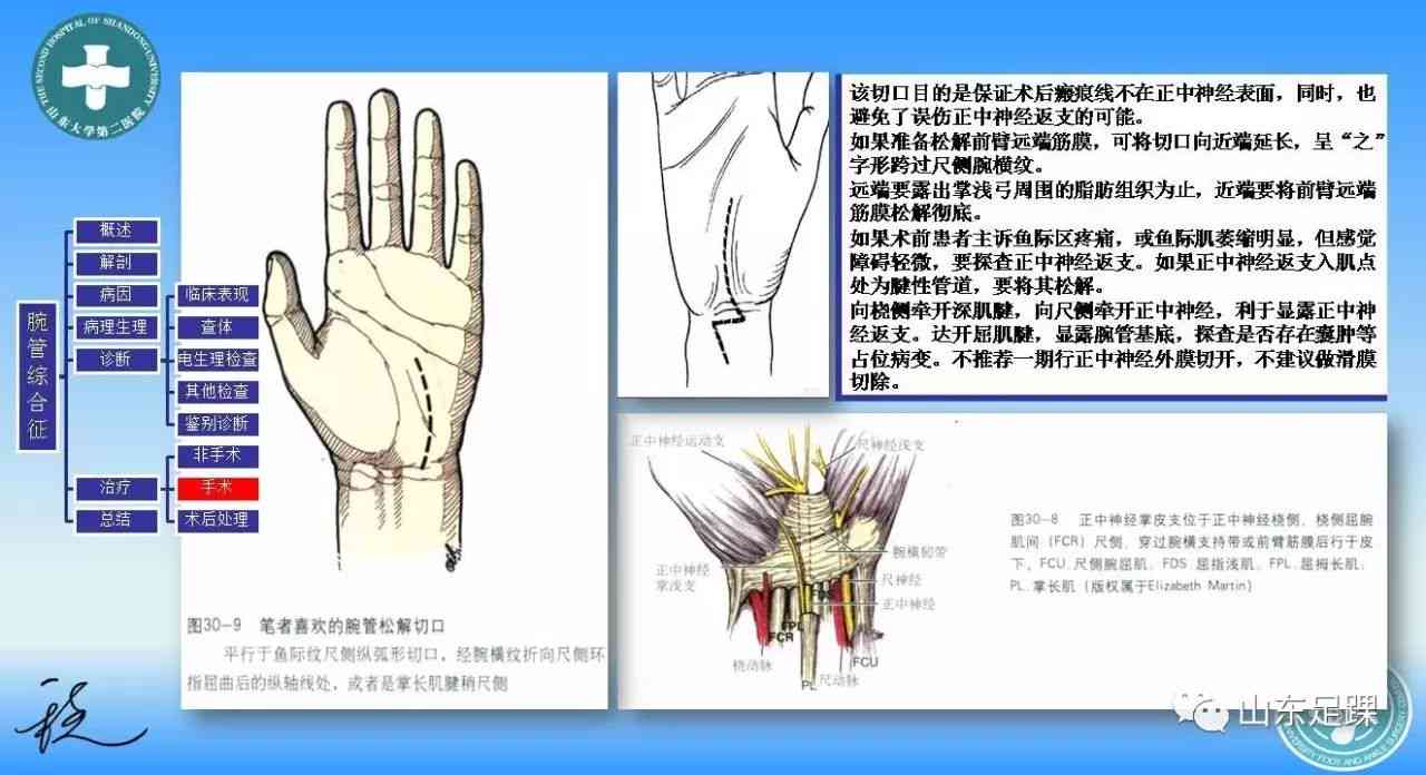 确诊腕管综合征后如何申请工伤鉴定及流程解析