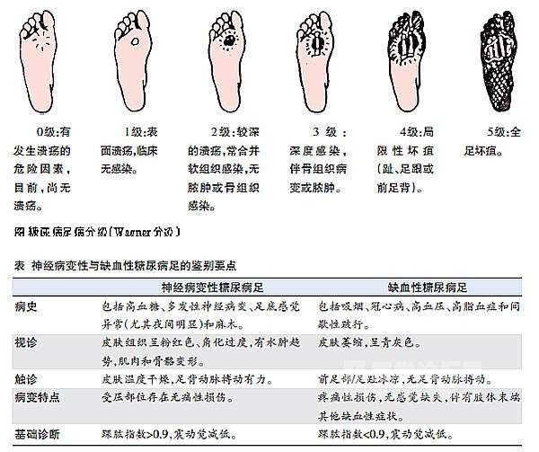 糖尿病患者截肢风险与预防措：全面解读截肢原因及复建议