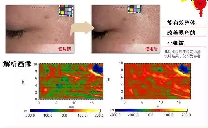 纤维环断裂：探讨修复可能性与恢复策略